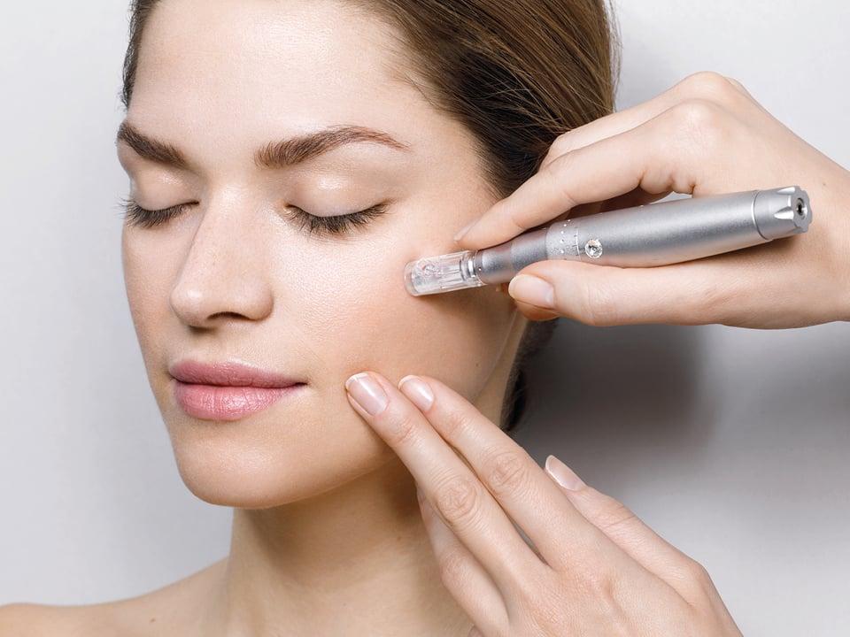 microneedling